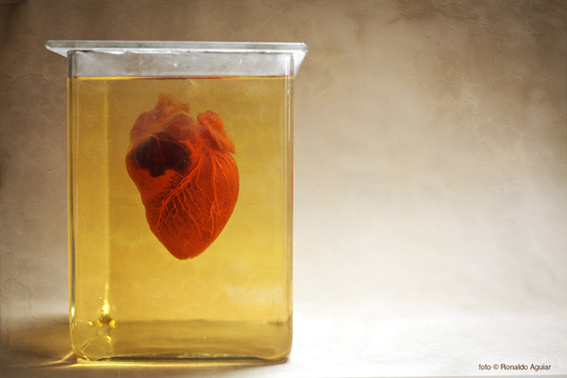 Coração humano preparado com injeção de gelatina e diafanização. Fotografia: Ronaldo Aguiar.